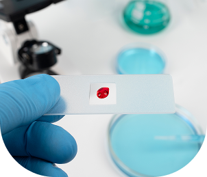 HIV Testing (VCT)